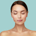 The Fountain of Youth Med Spa: Cheek Augmentation For Youthful Glow