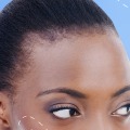 How Long Will Cheek Filler Last and Go Down?