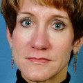 What is Face Augmentation? A Comprehensive Guide