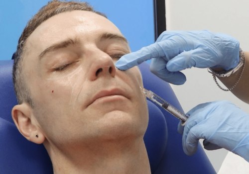 The Benefits of Cheek Fillers: A Guide to Injections